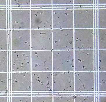 春のコロニーにおけるノゼマの監視 春のコロニーにおけるノゼマの監視 コロニーにおけるミツバチ病原体 ノゼマ の定量化ガイド このブログの定期購読者は、最近の 養蜂管理カレンダー の投稿で…