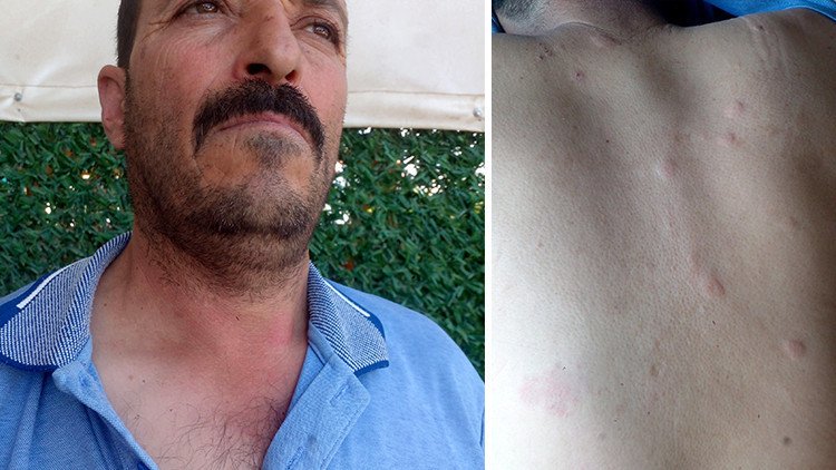 Duyduğu seslere giden çiftçi hayatının şokunu yaşadı! Ayı saldırısından kurtuldum derken dehşeti yaşadı