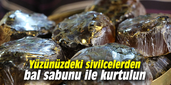 Yüzünüzdeki sivilcelerden bal sabunu ile kurtulun