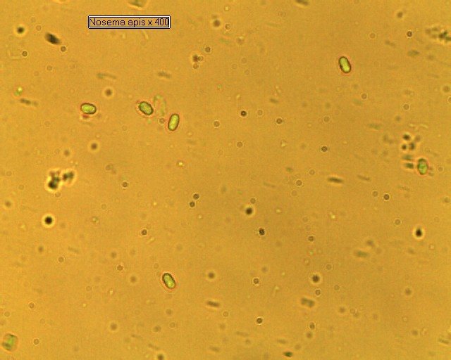 Nosema spores under the microscope