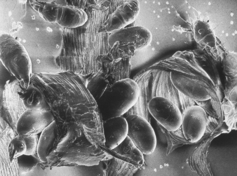 Mites and their oval eggs inside a trachea under the electron microscope