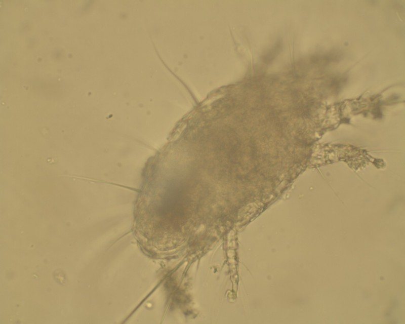Trake akarı (Acarapis woodi) mikroskopta