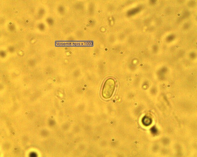 Nosema apis sporları mikroskopta (1000 büyütme)