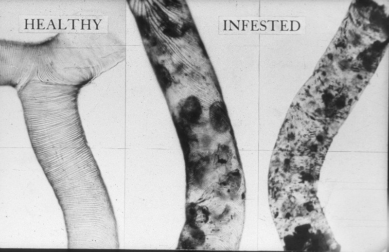 Healthy pale trachea on the left, dark-spotted infested tracheae on the right