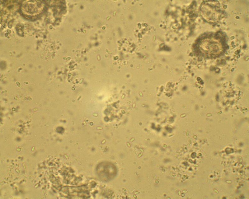 Nosema ceranae sporları mikroskopta (400 büyütme)