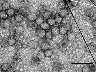 Round virus particles under the electron microscope