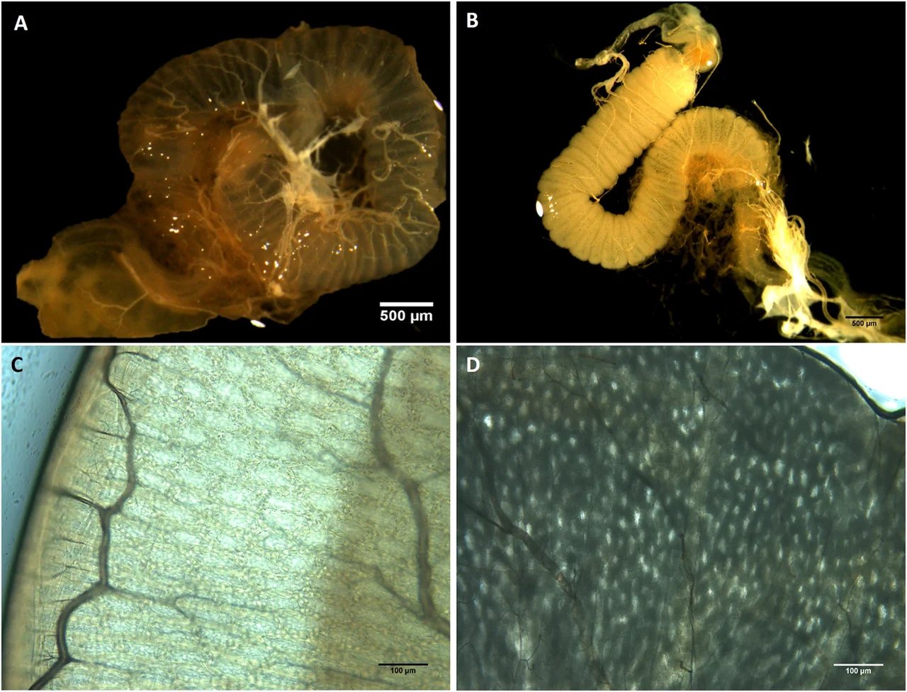 Comparison of healthy and nosema-infected drone midguts